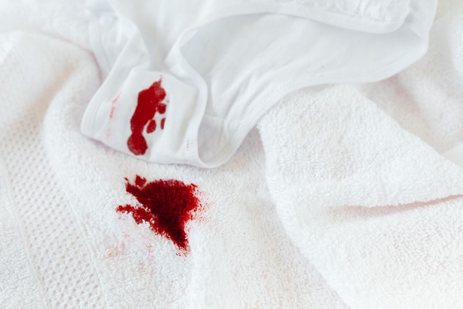 Spot treatment and stain removal on a woven area rug